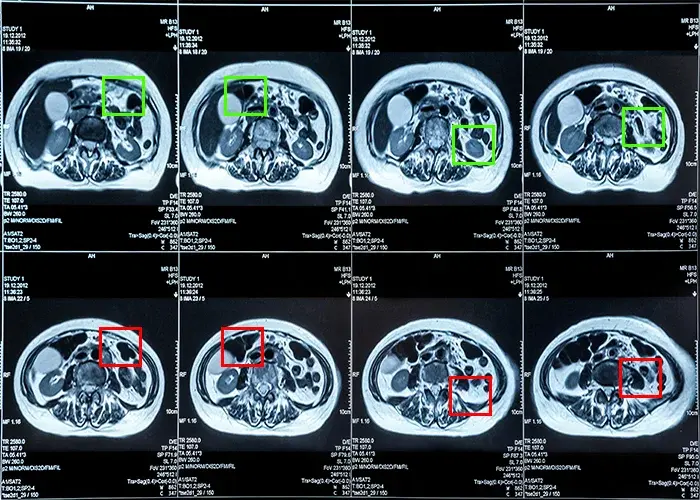 AI-Powered Medical Imaging in Healthcare
